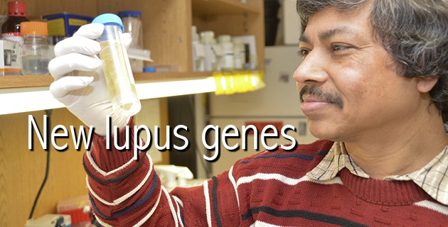 1/25/16 Researchers discover 10 new lupus genes in Asian population study